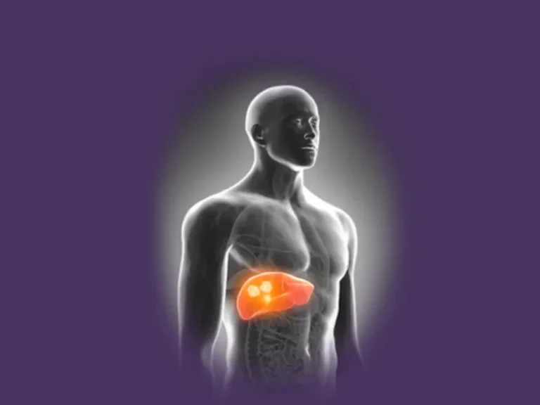 Цирроз печени — это не рак — знаки и симптомы цирроза Цирроз печени — это не рак — знаки и симптомы цирроза